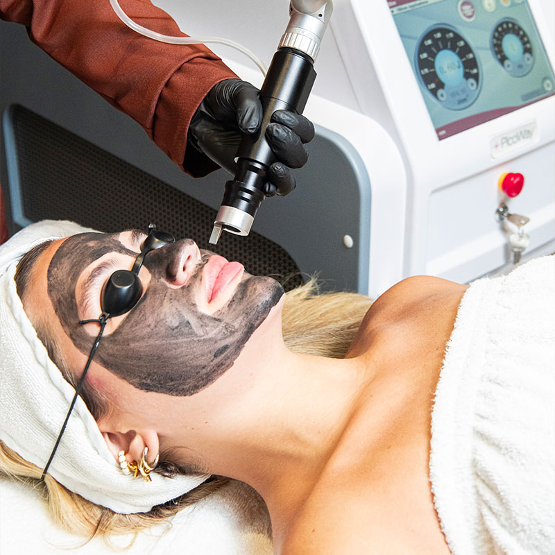 TRATAMIENTOS-FACIALES-CON-PRECISION